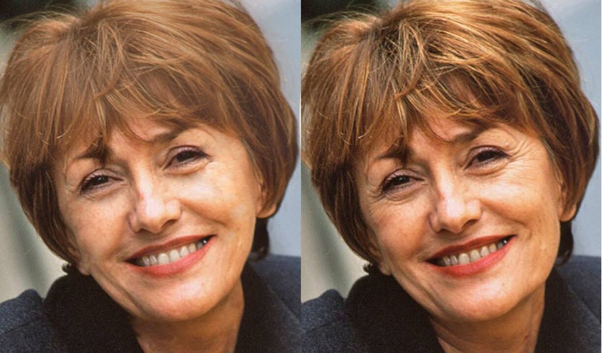 foto da cara antes e despois do contorno